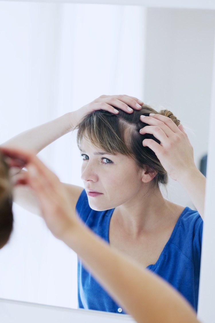 alopecia caída importante del cabello provoca estrés en el parto