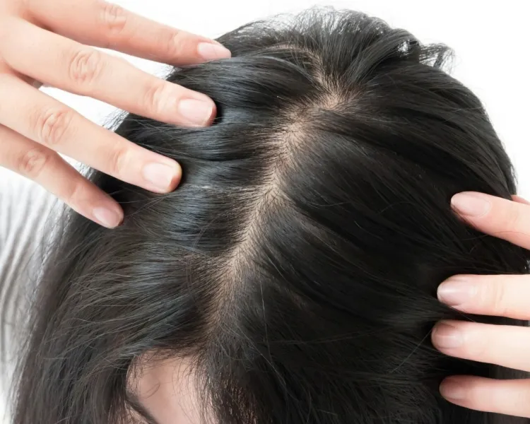 tratamiento anticaída detener la caída lenta del cabello