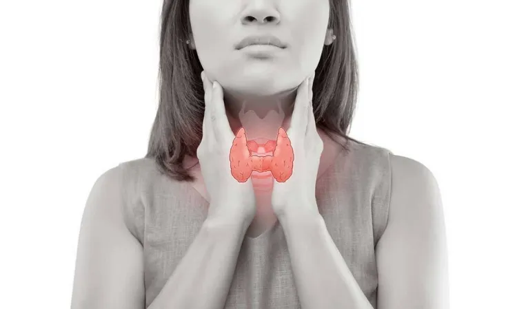 pérdida de cabello mujer tiroiditis autoinmune sífilis infección de transmisión sexual