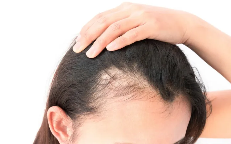 pérdida de cabello causas externas enfermedades hombre mujer después de covid