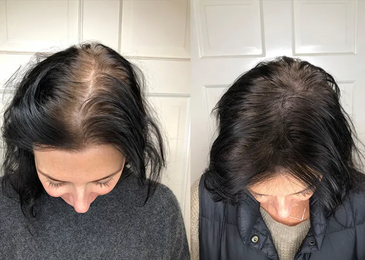 ¿De qué manera eliminar las canas sin recurrir a productos químicos? ¡El secreto definitivo para oscurecerlas! 4 - 【MioEstilo】 lavado de cafe canas pelo blanco antes despues