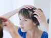 alopécie chute de cheveux causes types traitement