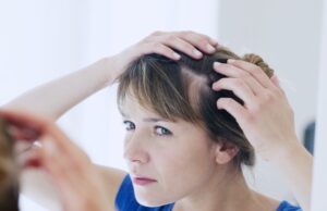 alopécie chute de cheveux causes types traitement
