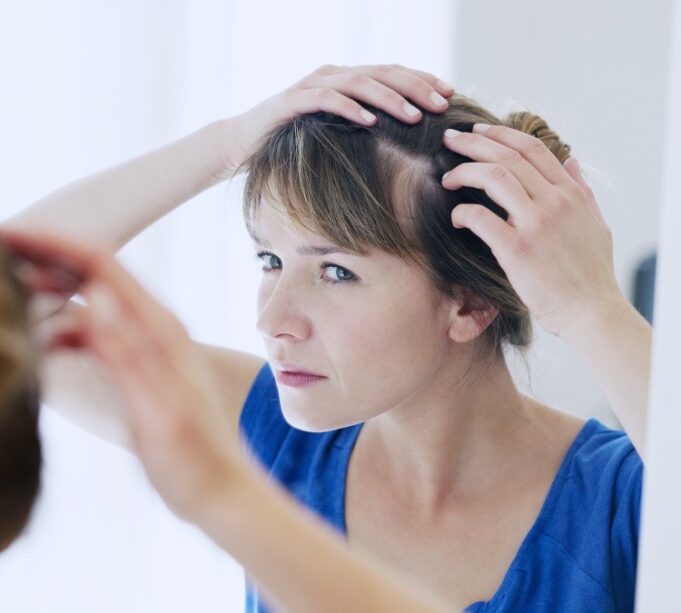 alopécie chute de cheveux causes types traitement